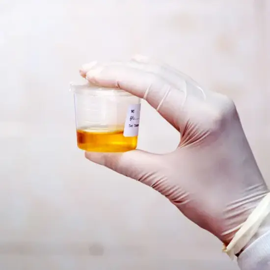 creatinine, random urine test